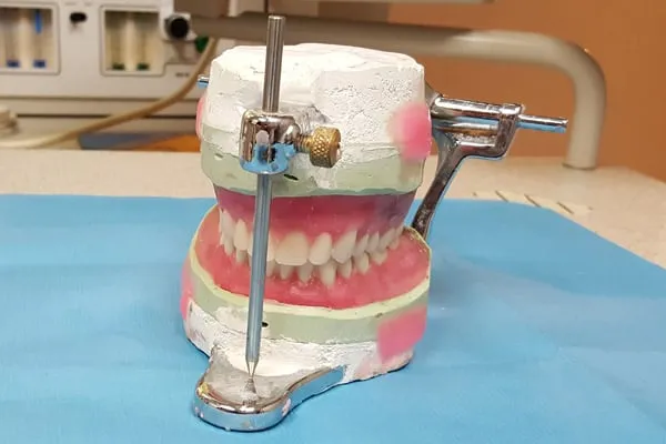Complete dentures being made in the lab