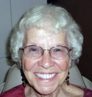 Smile after denture treatment