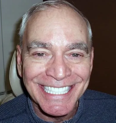 Smile after denture treatment, example 2