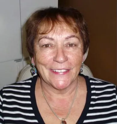 Smile before denture treatment, example 4