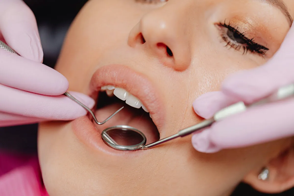 Full Arch Teeth Replacement