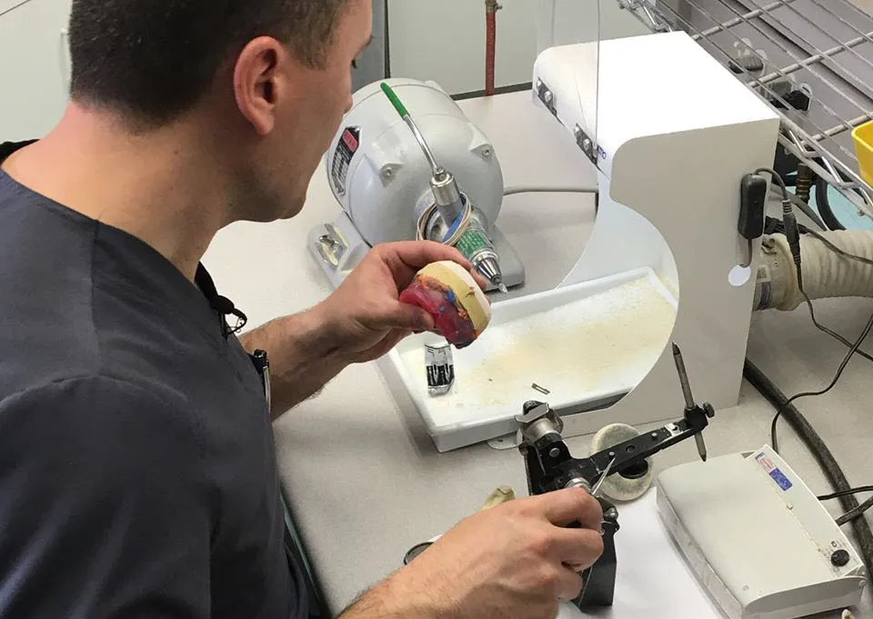 Cracked Denture Repair