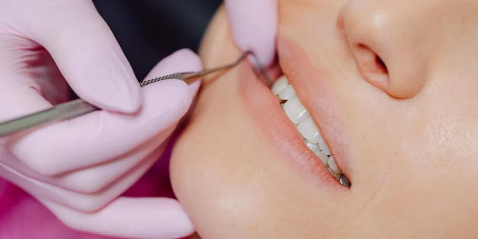 Partial dentures for replacing missing teeth