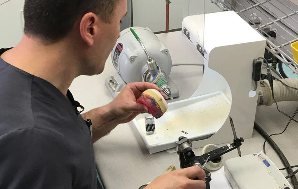 Denture Repairs in Calgary