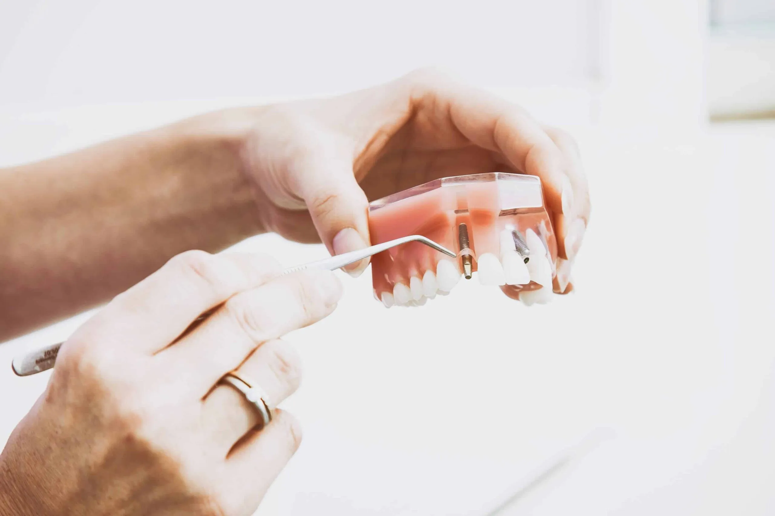How to clean and take care of your dentures