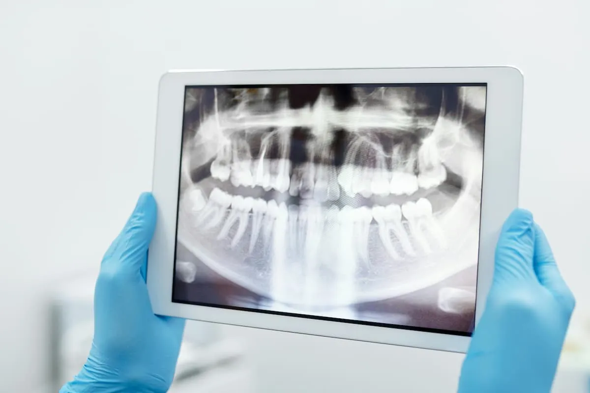digital dentures
