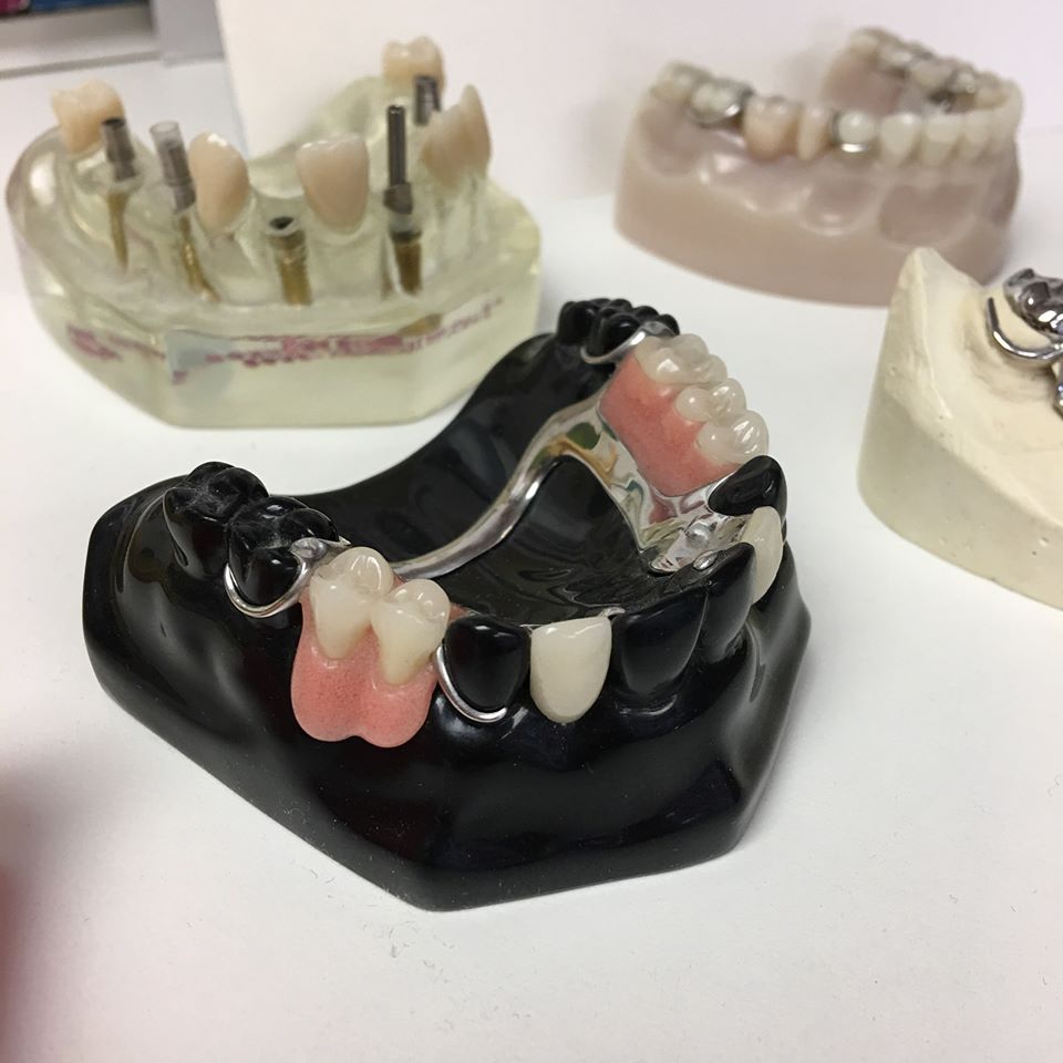 Dental vs Partial Dentures